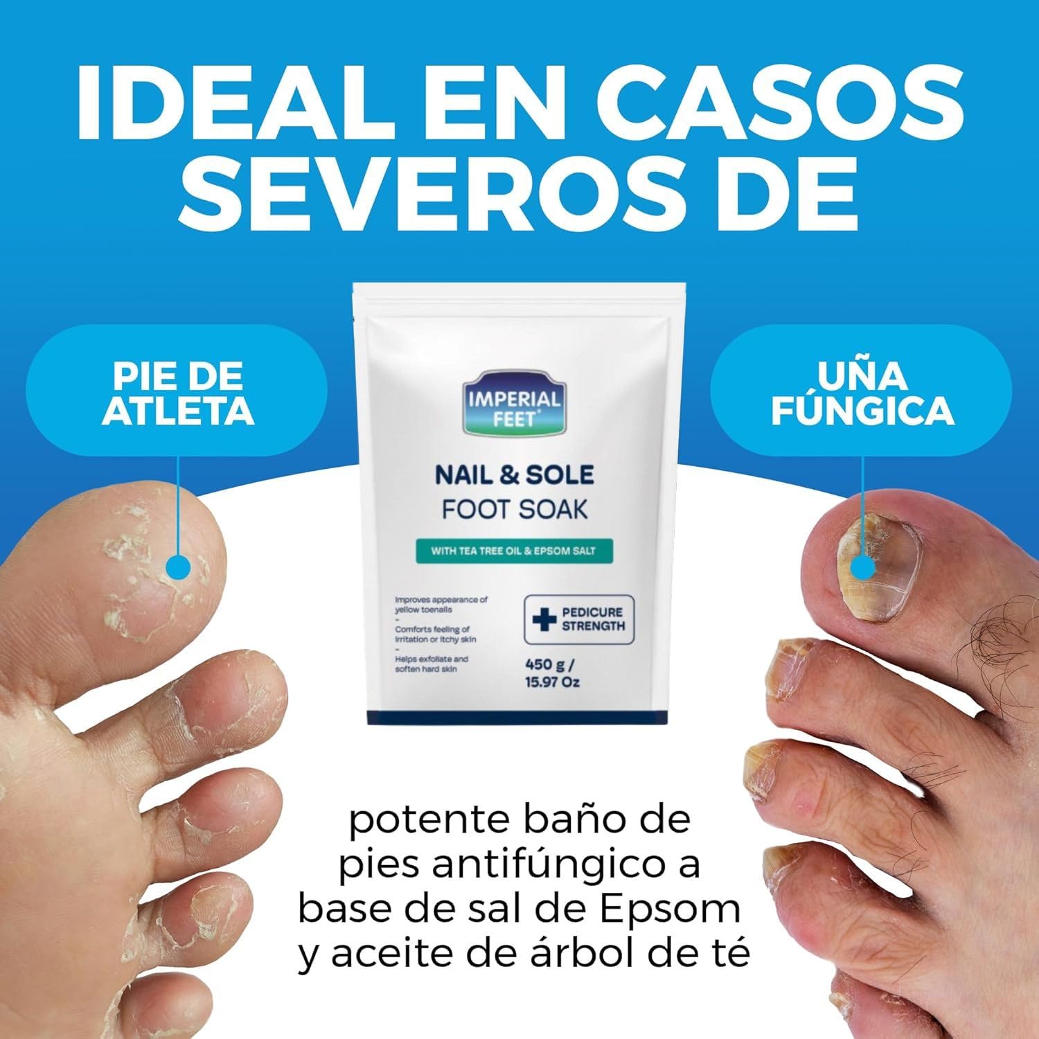 Remojo para Pies de Calidad de Pedicura con Aceite de Árbol de Té y Sal de Epsom | Ayuda a Tratar Hongos en las Uñas y Pie de Atleta - Hidratante y Desodorante para Pies | Remojo Exfoliante para Pie
