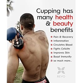 REVOMADIC REVO The Original 4-in-1 Smart Cupping Therapy Massager, Red Light Therapy for Targeted Pain Relief, Knots, Aches, Muscle Soreness, Circulation & Tighter Skin, Portable Cupping Kit