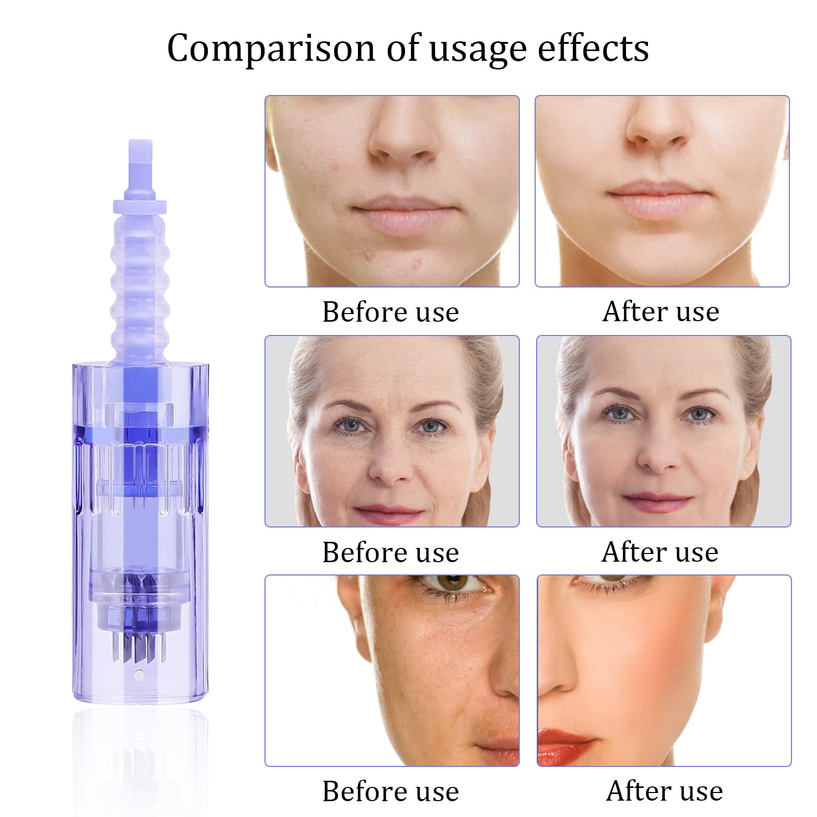 30 Pezzi Aghi Di Ricambio 36pin Dermapen Microneedling Confezionata Singolarmente Micro Aghi Dermapen Per Auto Electric Deep Microaghi Derma Pen Adatta alla Baionetta Penna Micro-ago