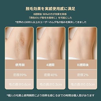 アジア人向けの冷感脱毛器 脱毛器 VIO対応 庭用 光美容器 男女兼用 アジア人向けの冷感脱毛器 脱毛器 VIO対応 庭用 光美容器 男女兼用