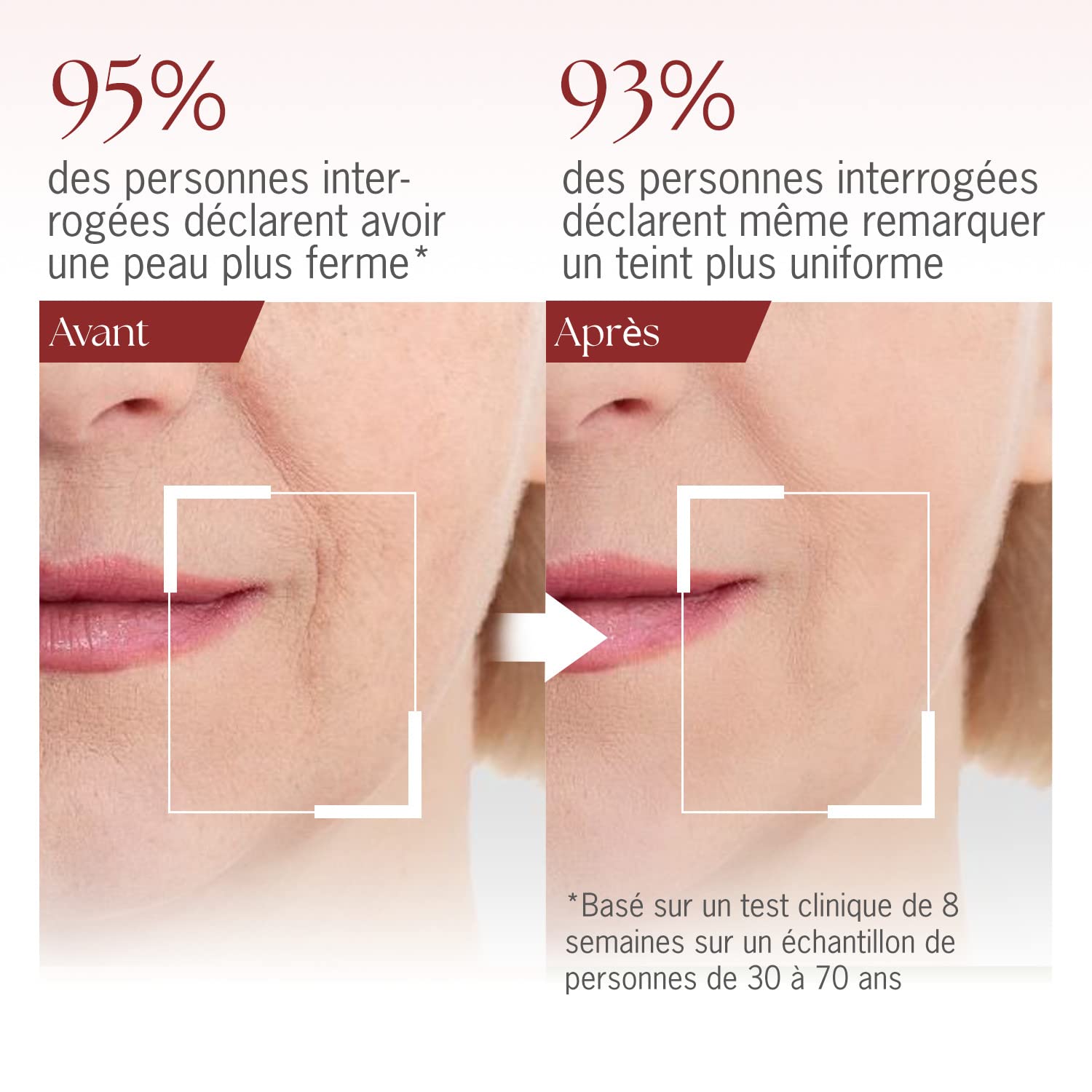 Retinol Sérum Visage + Haute Dose Acide Hyaluronique Pour un Effet Lifting Immédiat + Peptides Anti-Âge, Vitamines A, B5 et E - Sérum Anti-Rides Raffermissant - Fabriqué en Allemagne