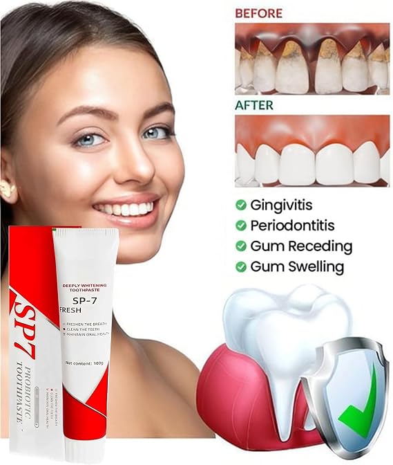 Sp-7 Probiotic Toothpaste, Sopami Sp-7 Probiotic Toothpaste, Sp-7 Probiotic Stain Removal Toothpaste, Deep Cleaning Toothpaste