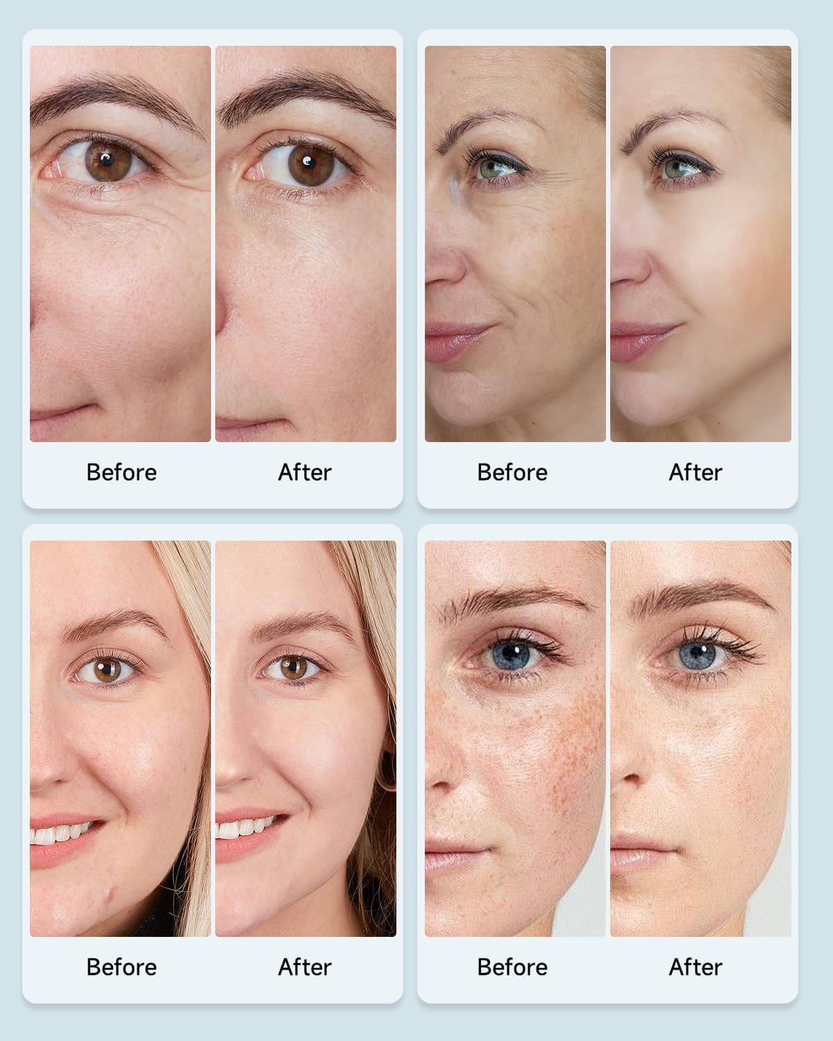 Beauty-LED-Maske, LED-Gesichtsmaske, Lichttherapie