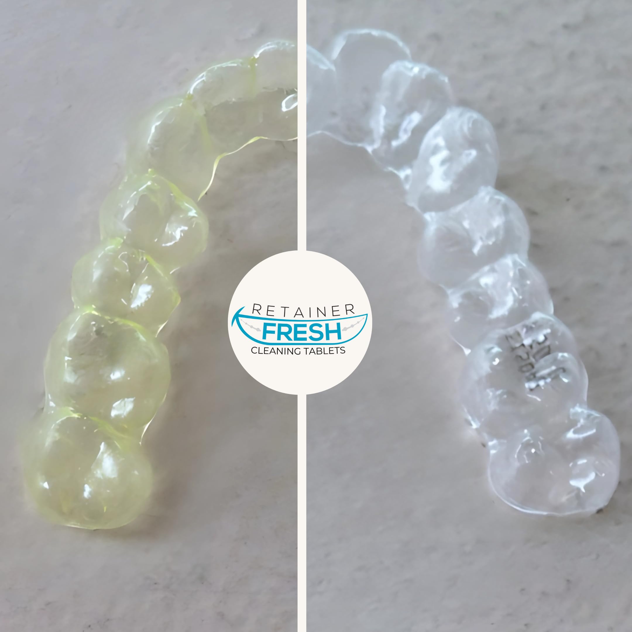 Retainer-Set mit 36 ​​Retainer-Fresh-Tabletten, Retainer-Etui, Aligner-Reinigungsbox, Aligner-Entfernung und Kauen, kieferorthopädisches Wachs, Aligner-App und E-Book