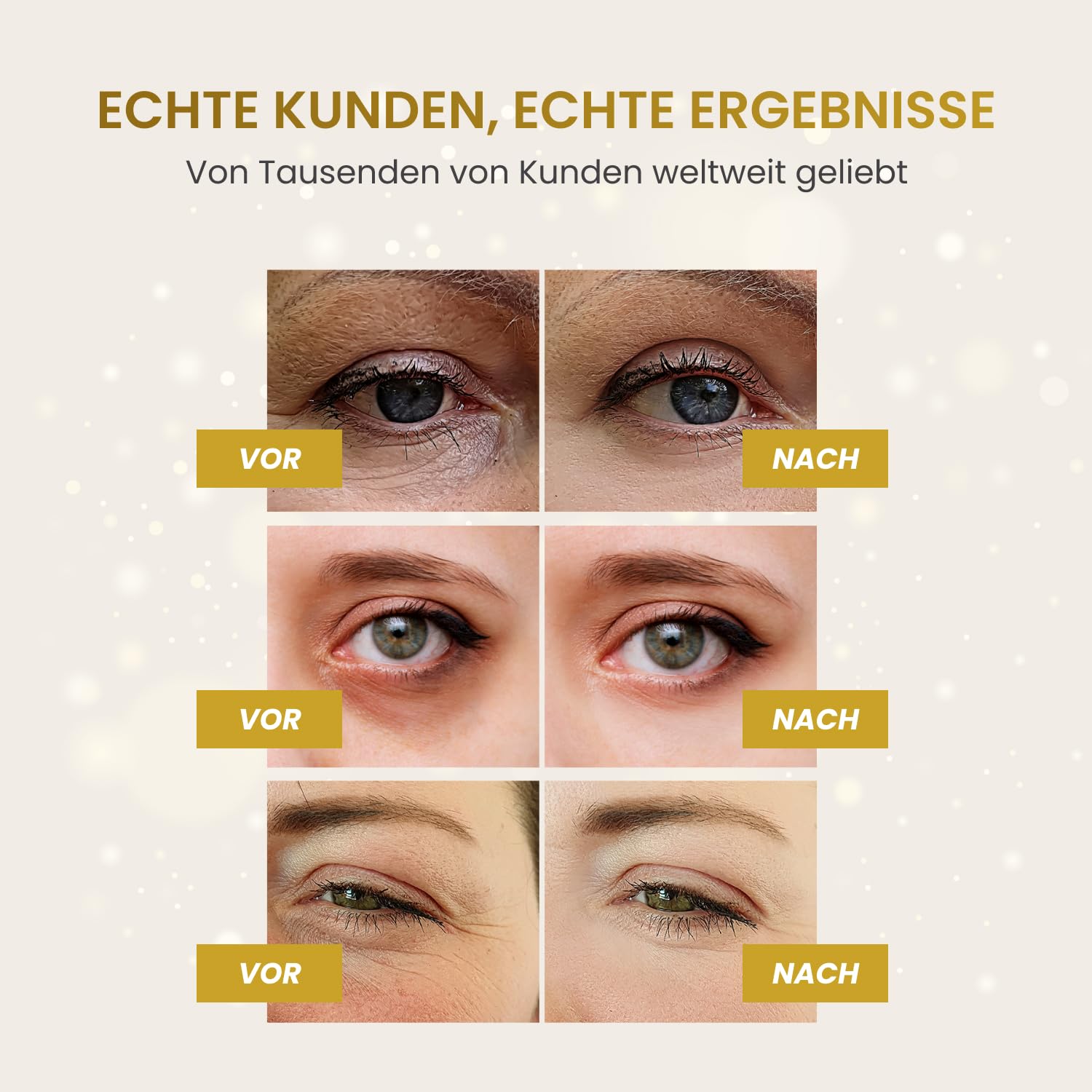PLANTIFIQUE 20 Paar Augenpads Gegen Augenringe und Tränensäcke & Vitamin C Serum Gesicht Korean Skin Care Anti Aging Gua Sha Massage Face Serum, 30 ml