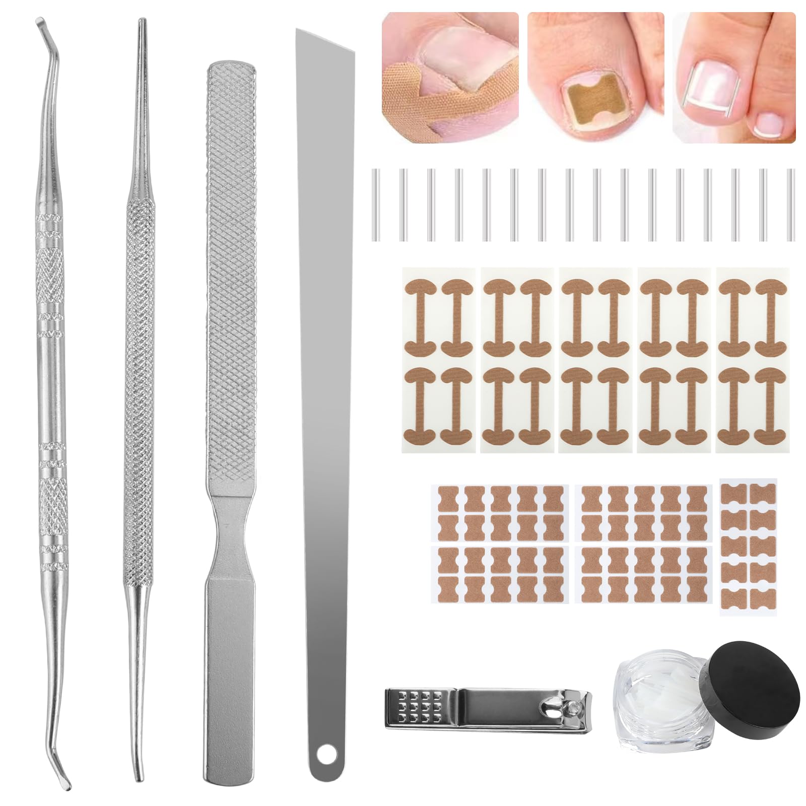 76Pcs Ingrown Toenail Tool Set with Reinforced Adhesive Strips, Ingrown Toenail Care Kit for Home Pedicure, Upgraded Stainless Steel Lifter and File for Men and Women, Silver & Brown