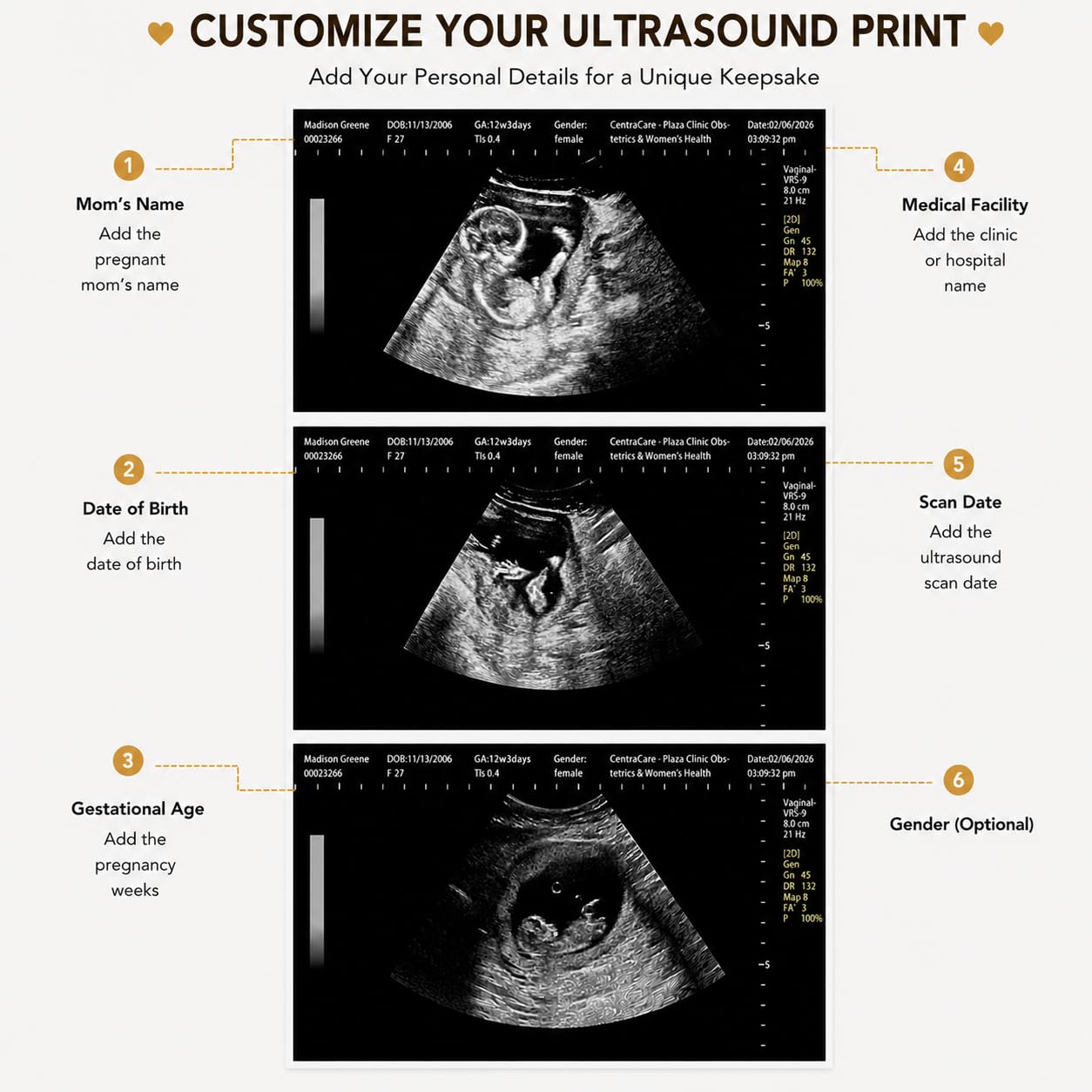 Fałszywe Ultradźwięki Ciążowe Na Żart, Spersonalizowane Fałszywe Zdjęcie Ultrasonograficzne, Niestandardowe Zdjęcie Ultradźwiękowe Na Zabawne Ogłoszenie Ciążowe, Fałszywe Ultradźwięki Bliźniacze Na