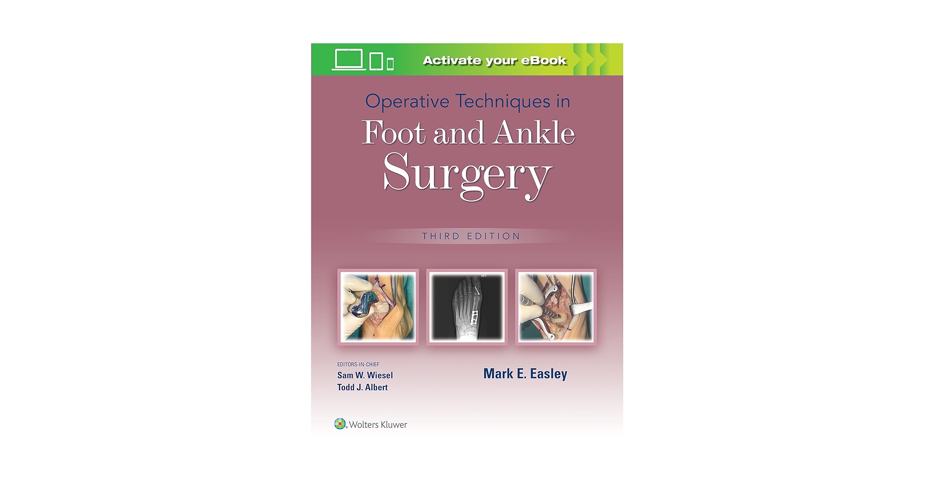 足と足首の手術　Surgery of the foot and ankle 2冊 41li4kUexJL.jpg_BO30,255,255,