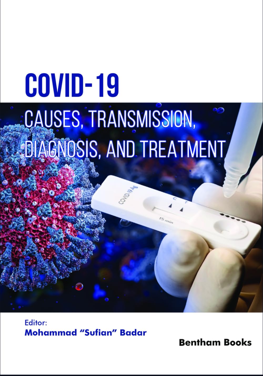COVID-19: Causes, Transmission, Diagnosis, and Treatment