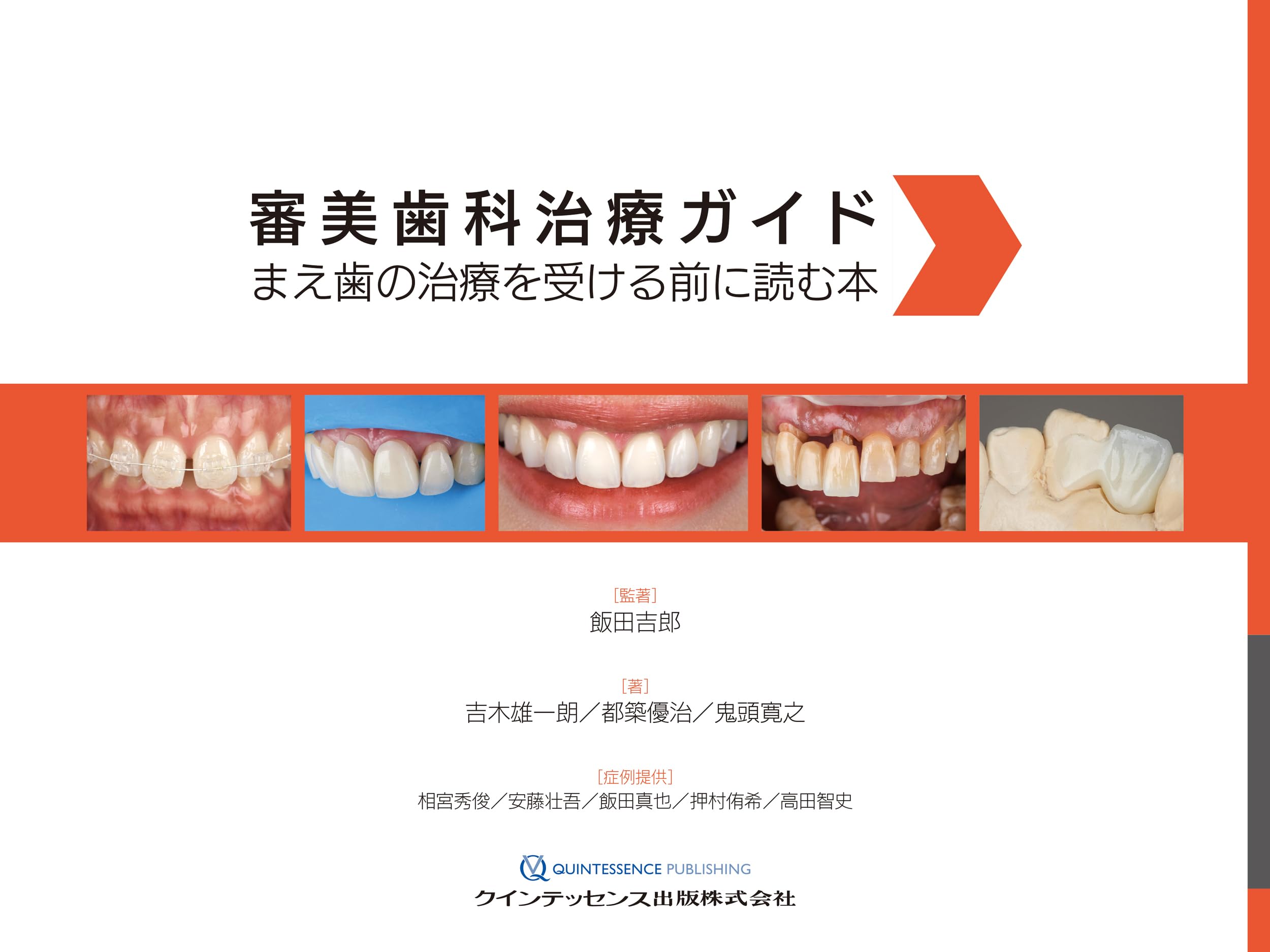 理想的な審美を求めた口腔形成外科手術　1・2・3　全3巻セット 専門医取得に必要な形成外科手技37 上 | 克誠堂出版