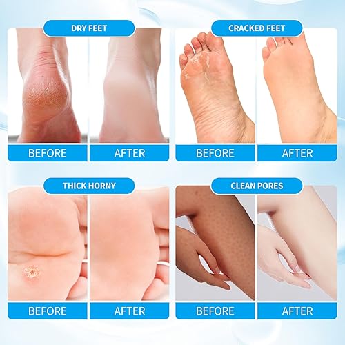 Miniatura 88 de Kit de pedicura para pies remojados: sal de burbujas, exfoliante de azúcar, máscara de masaje, loción de masaje en una caja, kit de spa de 4 pasos