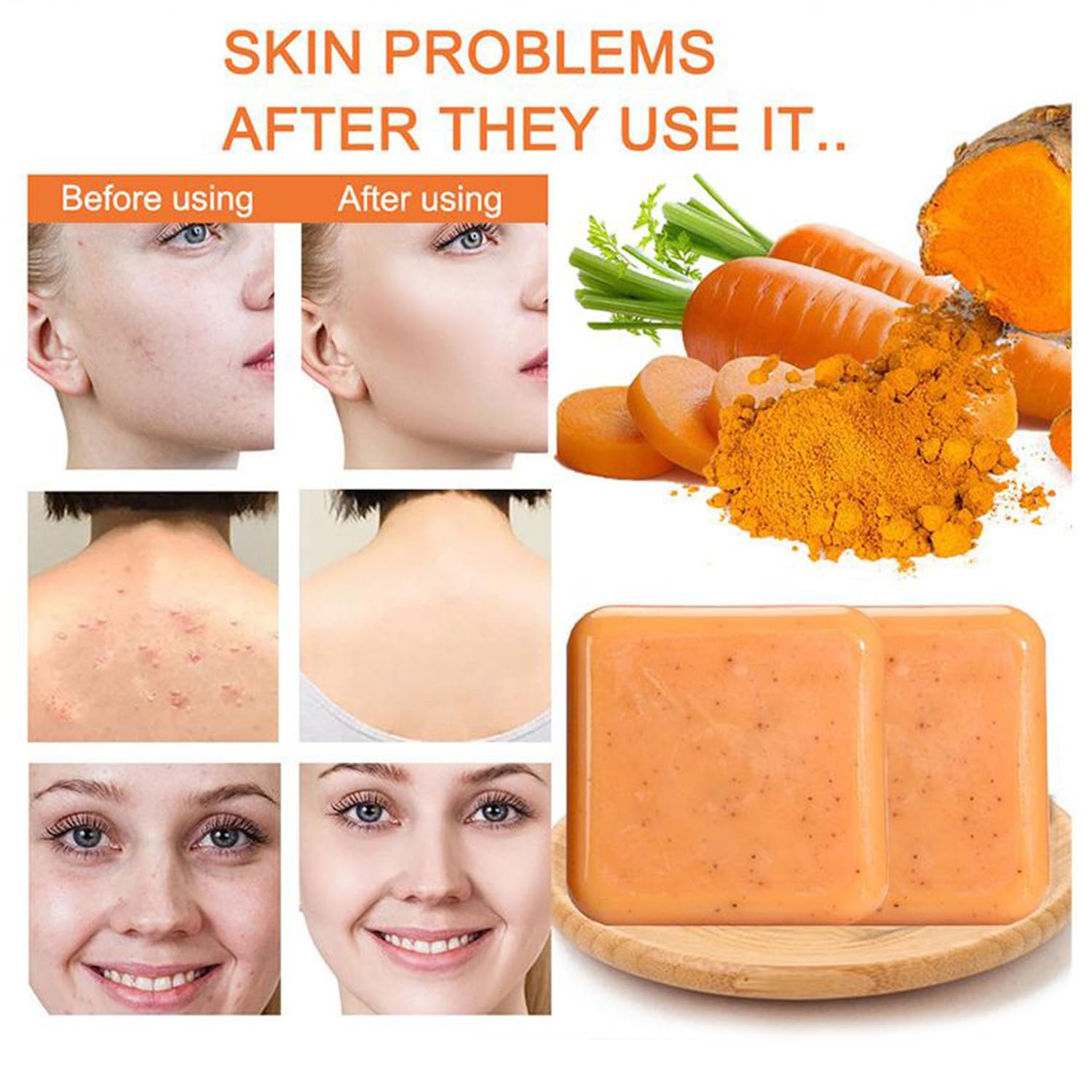 2Pcs Turmeric Soap, Turmeric Soap Natural Carrot Turmeric Soap Bar, Carrot Scrub Soap - Image 3