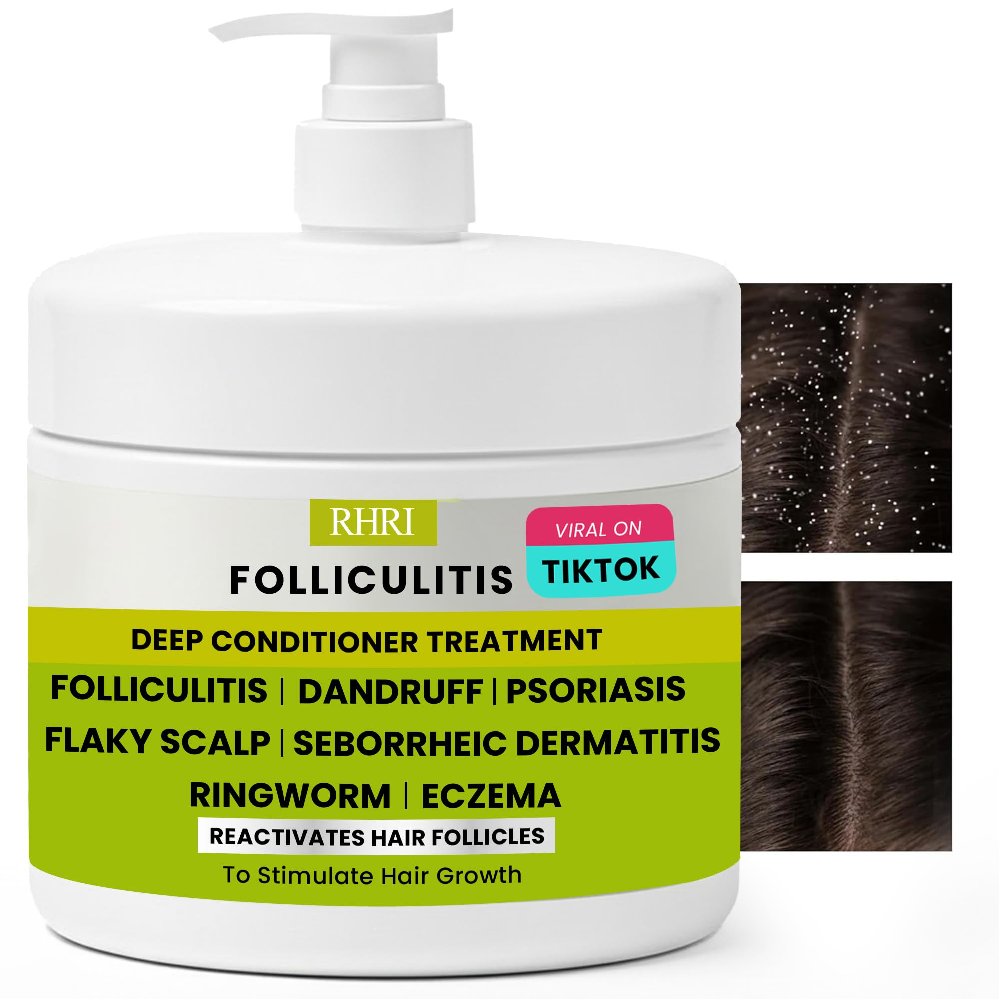 Folliculitis Deep Conditioner | Effective Scalp Treatment for Seborrheic Dermatitis, Psoriasis, Dry Itchy Scalp, Dandruff Treatment | Nourishes Oily Hair and Promotes Healthy, Hydrated Hair Treatment