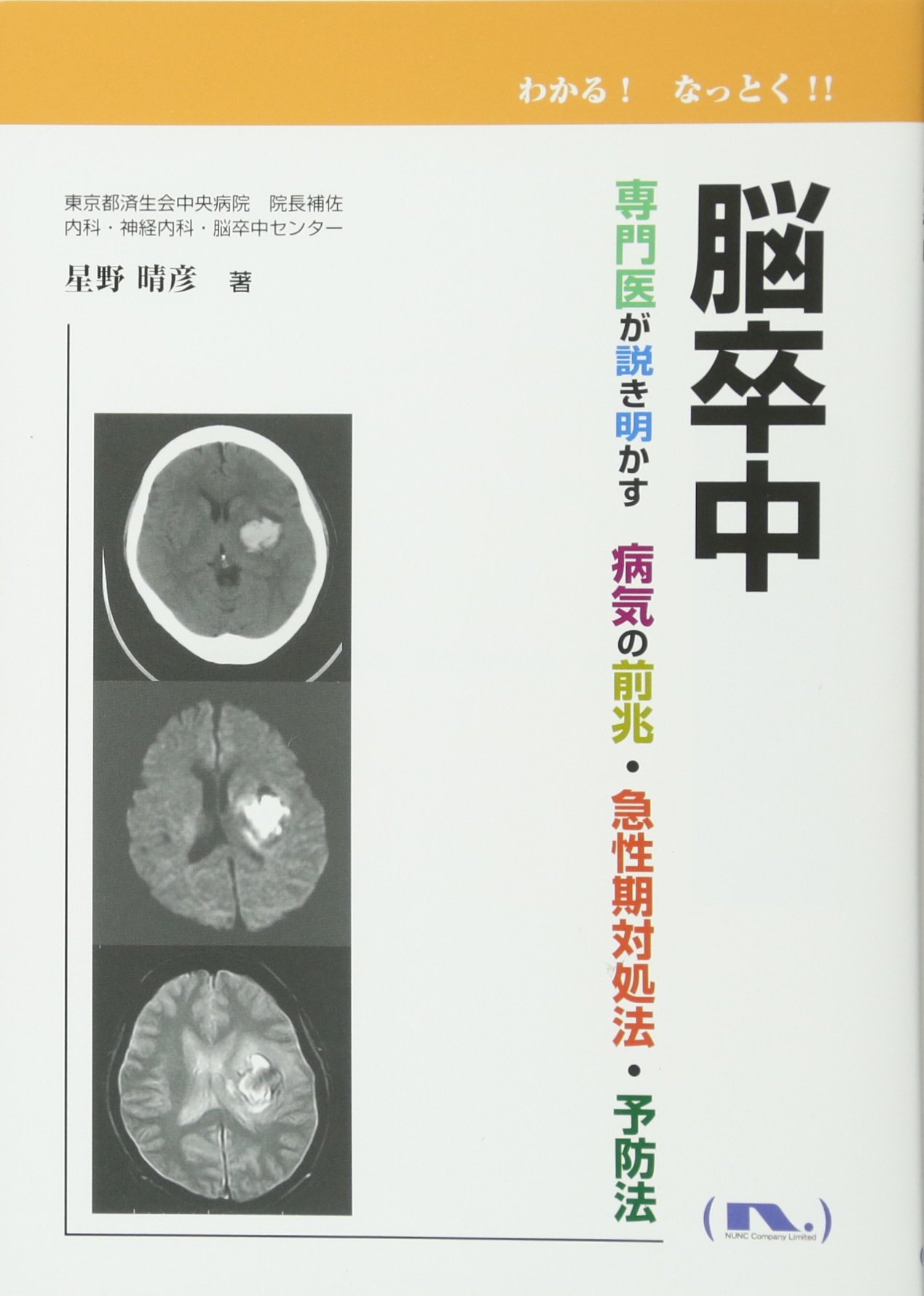 脳卒中　最前線 脳卒中最前線第4版急性期の診断からリハビリテーションまで