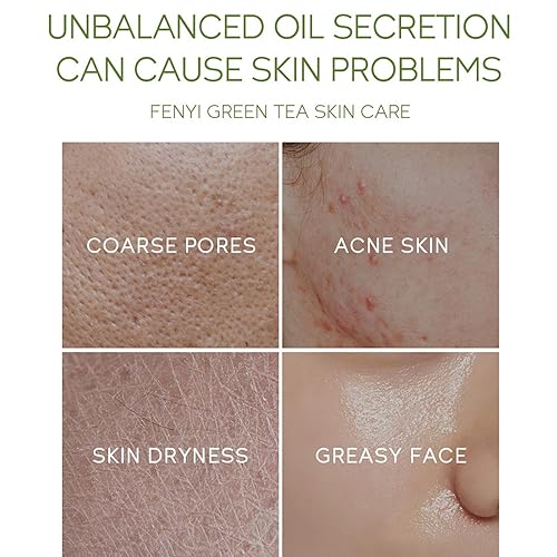 Miniatura 2 de Rosarden Set de cuidado de la piel de té verde para mujeres, rutina de cuidado de la piel de plantas, kit de rutina de cuidado de la piel para