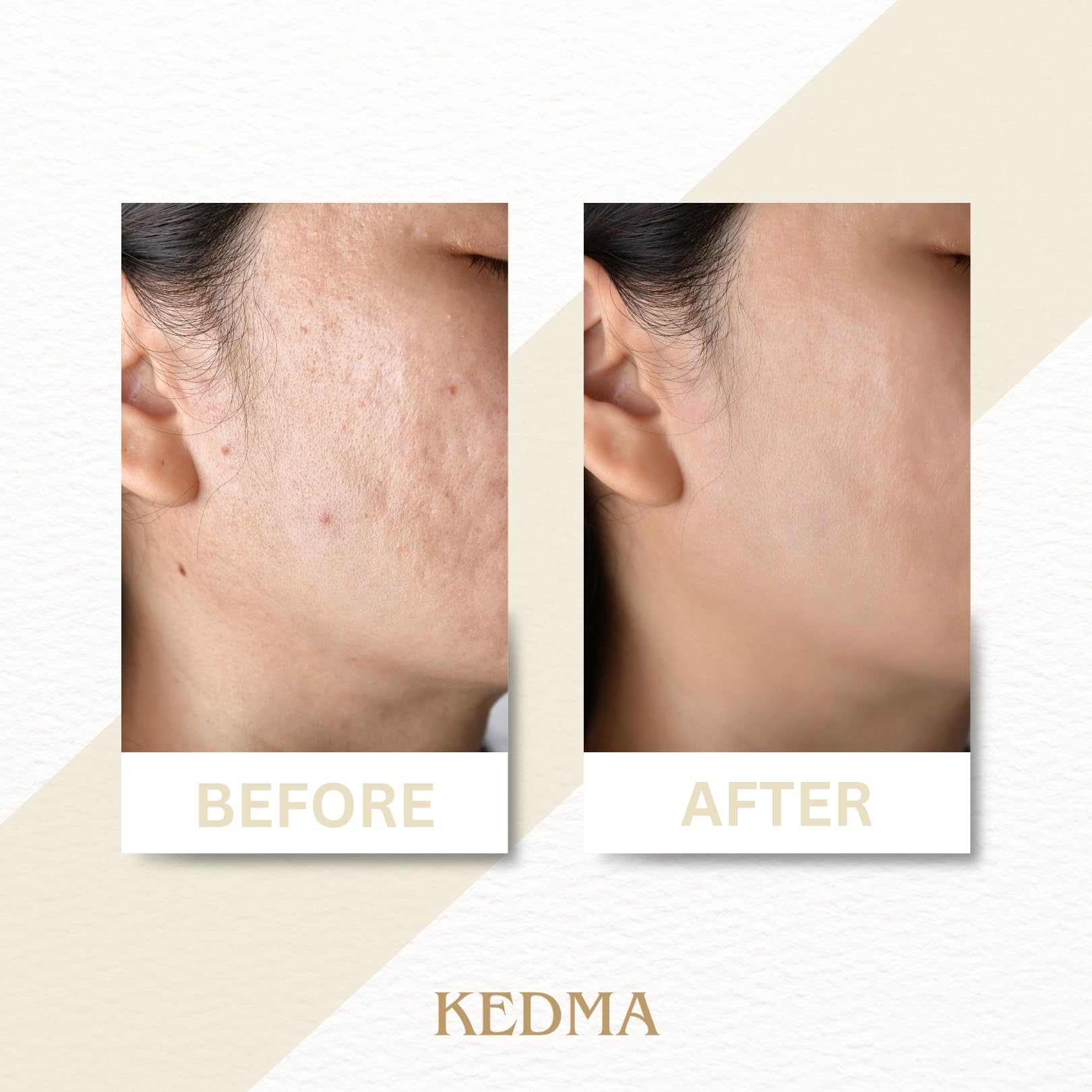 KEDMA - Masque Purifiant à la Boue Noire - Pour Tous Types de Peau - 50g | Le masque à la boue noire purifie, absorbe l’excès de sébum et aide à affiner l’apparence des pores.