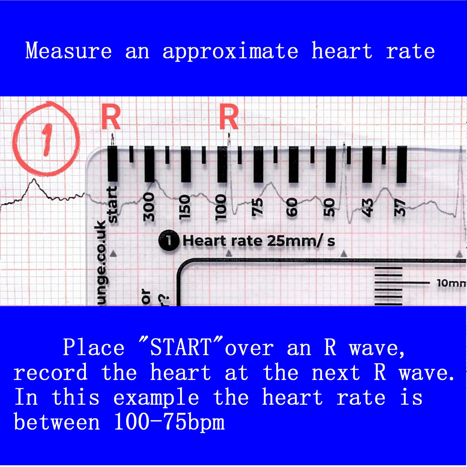 ECG Ruler - 7 Step EKG Interpretation Guide -3