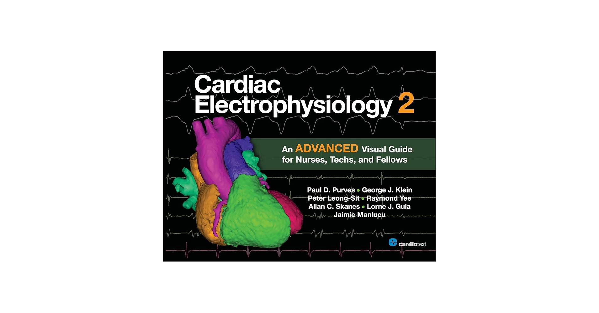 Cardiac Electrophysiology 2: An Advanced Visual Guide for