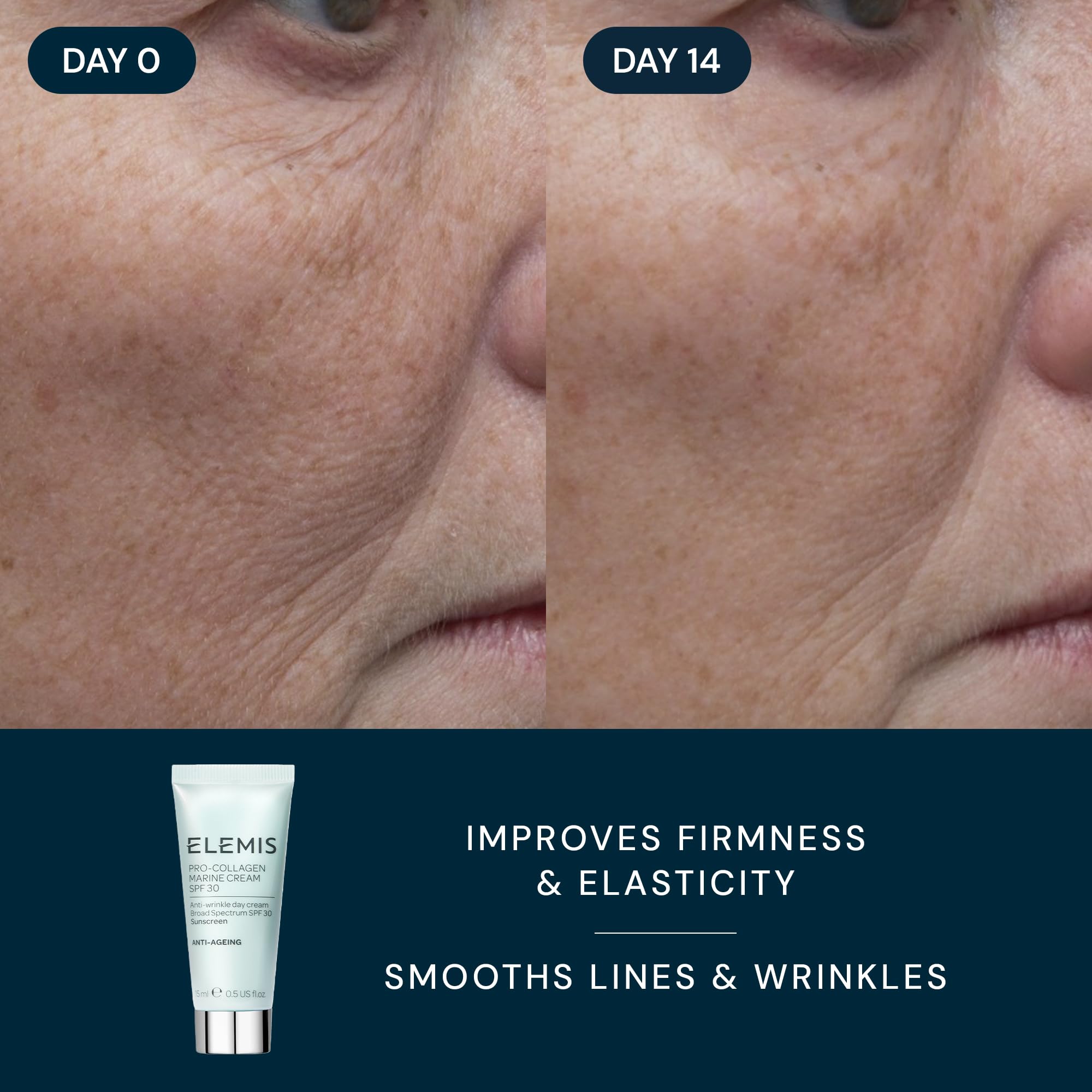 ELEMIS Healthy Skin Exclusive Travel Set | Pro-Collagen Cleansing Balm Mini, Marine Cream SPF 30 Mini & Dynamic Resurfacing Pads | Anti-Aging Hydrating Skincare Travel Kit