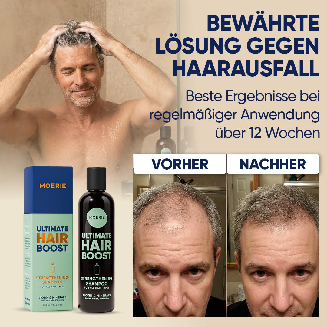 Haarwachstum Shampoo gegen Haarausfall – Biotin und Koffein Haarwuchs Shampoo für Frauen und Männer – haarwachstum beschleunigen, reduziert Haarverlust