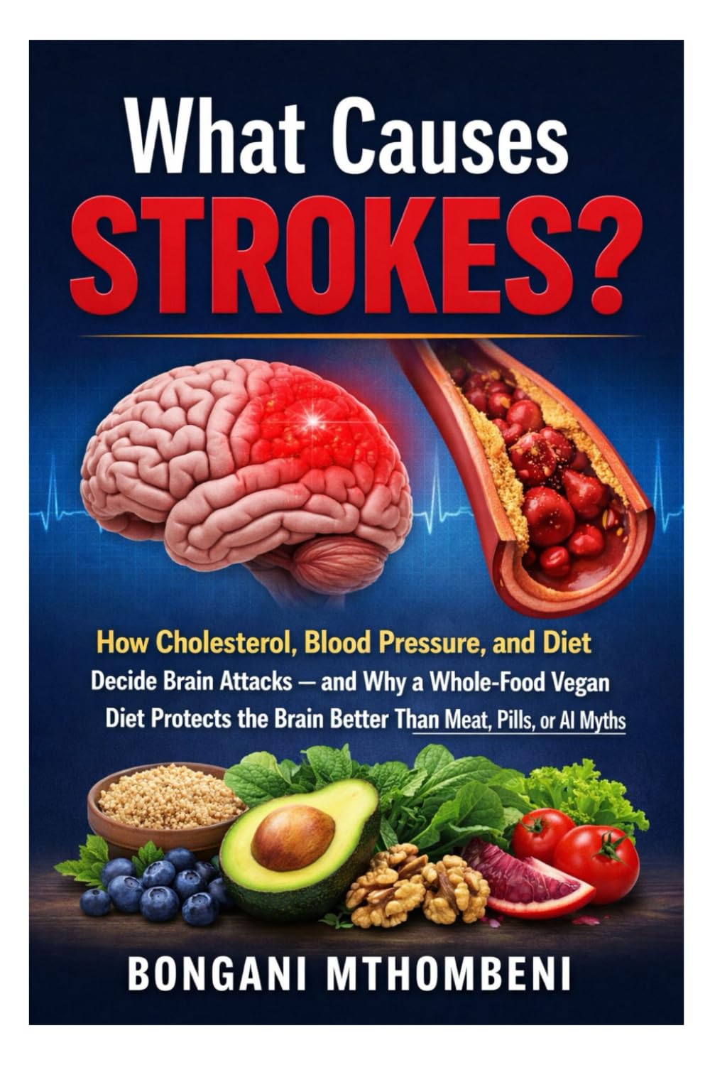 What Causes Strokes?: How Cholesterol, Blood Pressure, and Diet Decide Brain Attacks — and Why a Whole-Food Vegan Diet Protects the Brain Better Than Meat, Pills, or AI Myths