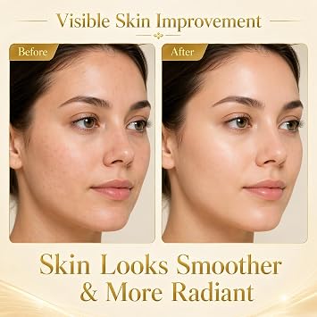 Deep Collagen Silk Peptide Intensive Lifting Ampoule | Anti Aging Serum for Tightening & Firming | Smoothing Appearance of Fine Lines | Micro Infusion System | Korean Skincare Face Glow Serum | 50ml