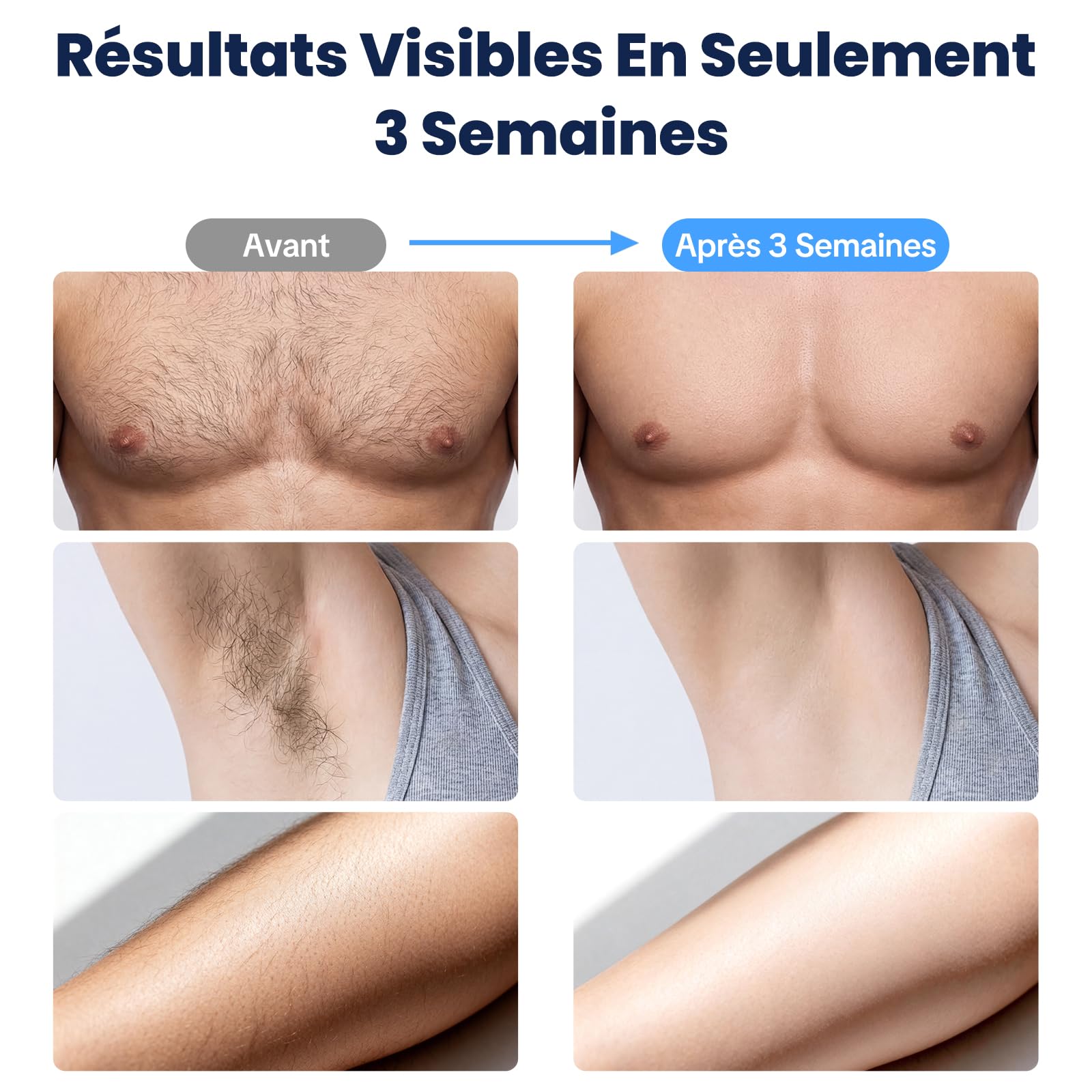 MANKIW Épilateur Lumière Pulsée avec Fonction de Refroidissement, 5 Niveaux d’Énergie & 500000 Flashs, Modes Automatique et Manuel, Alternative à l’Épilateur Laser, pour Jambes, Aisselles et Bikini