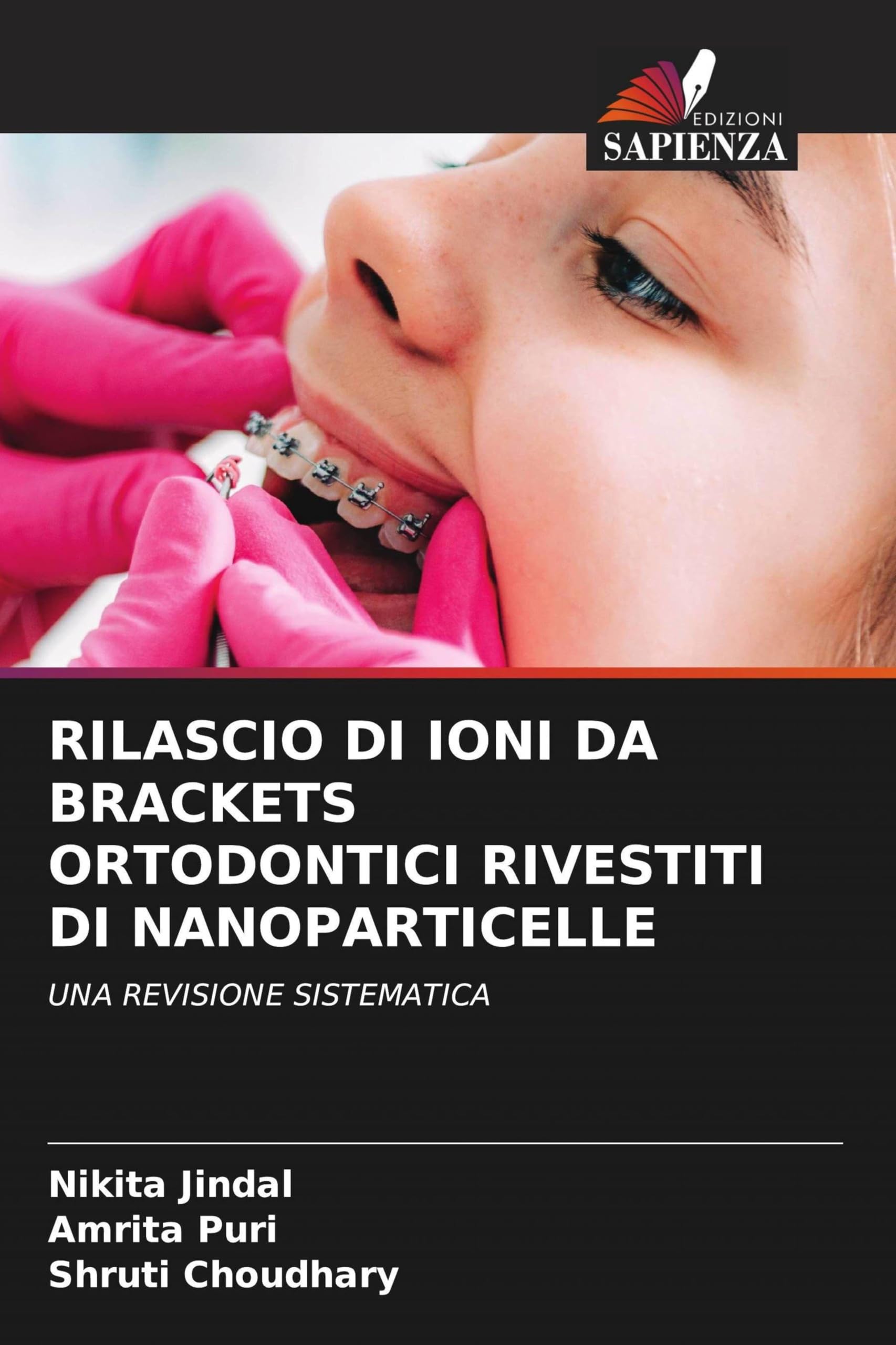 Rilascio Di Ioni Da Brackets Ortodontici Rivestiti Di Nanoparticelle: UNA REVISIONE SISTEMATICA