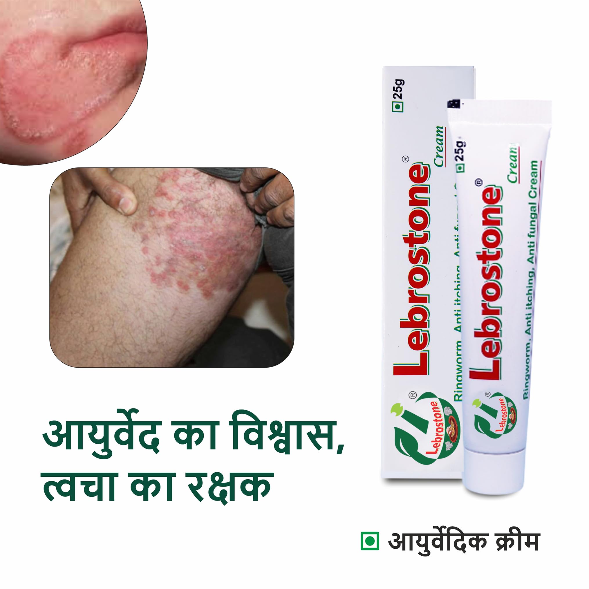 Lebrostone Cream Ayurvedic Treatment for Ringworm, Anti Itching, & Anti Fungal Infections (25 (Gram) Pack of 4, 100, gram)