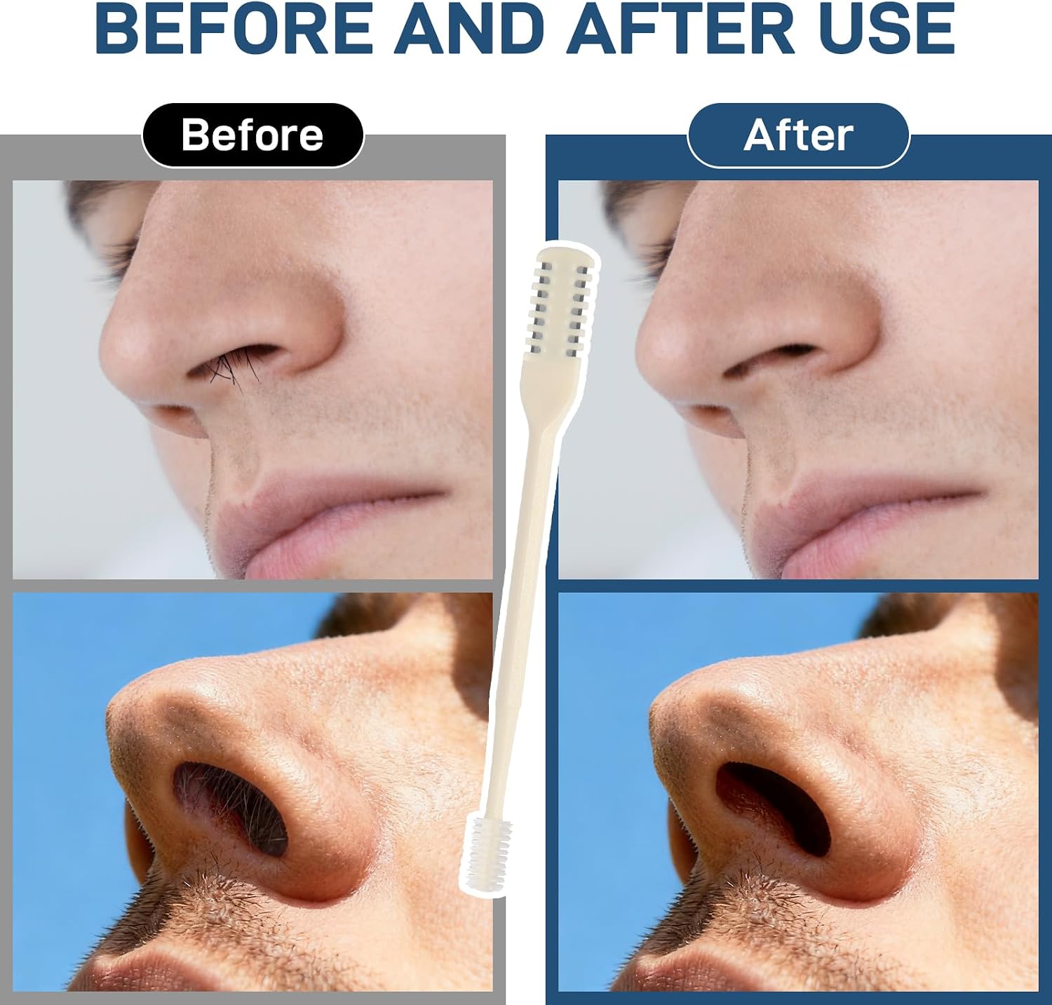 Nasal Hair Cutter, Double Sided Nose Hair Knife, 360° Nostril Hair Remover Tool, Nose Hair Trimmer for Men Women, with Soft Cleaning Brush (Beige)