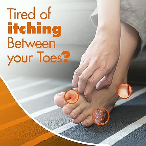 Miniatura 2 de Spray antifúngico para el tratamiento de pies de atletas, alivia la picazón, el ardor y el enrojecimiento, fórmula de secado rápido para tiña y