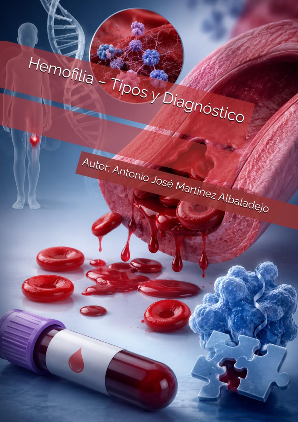 Hemofilia – Tipos y Diagnóstico