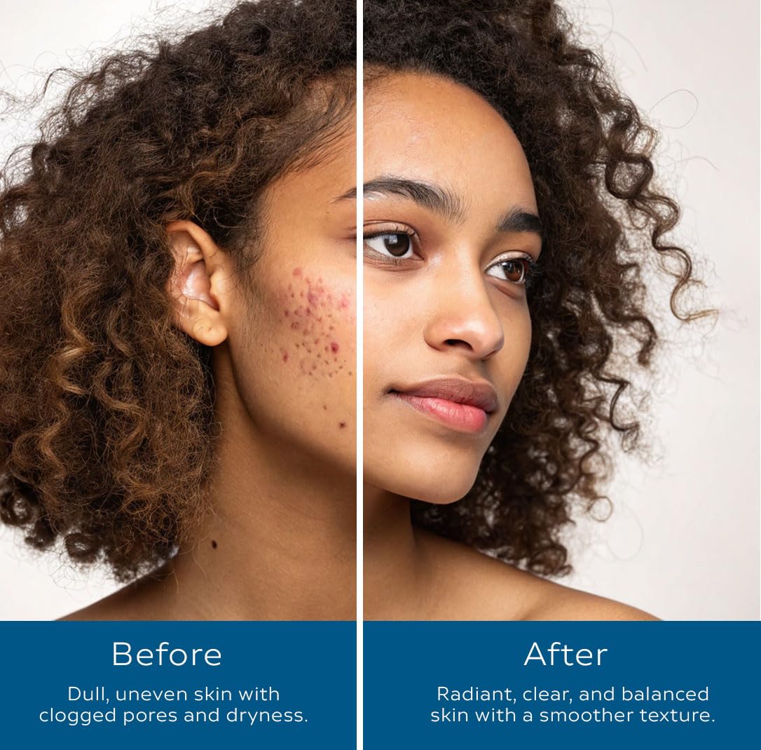 Neptune Skincare 3-Piece Bundle | Fresh Water Cleanser, Deep Sea Hydrate Moisturizer & Black Sea Mud Scrub | Deep Cleansing, Hydrating & Exfoliating | 100% Natural, EWG Verified | For All Skin Types - Image 4