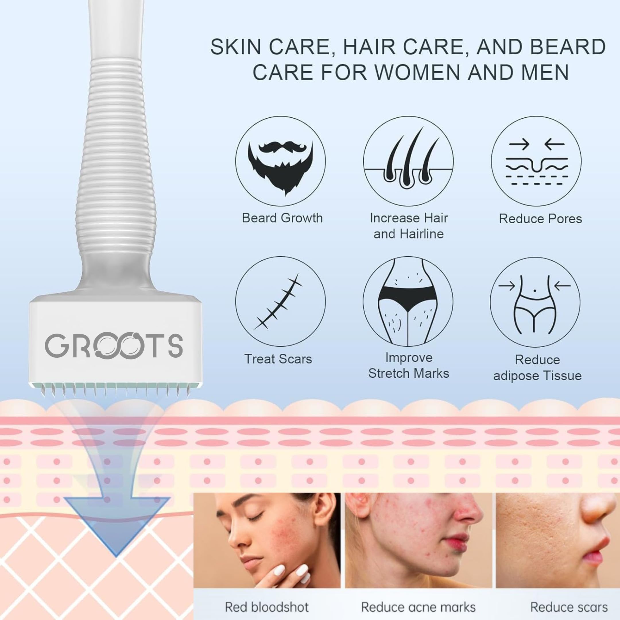 GROOTS Derma Stamp for Hair Growth & Facial Spa | Titanium Coated Adjustable Needles 0.25mm to 3mm | 140 Microneedling Stamp for Skin Repair, Face, Hair & Beard Growth | Reduces Acne Scars | Safe & Effective To Use - Image 5 thumbnail