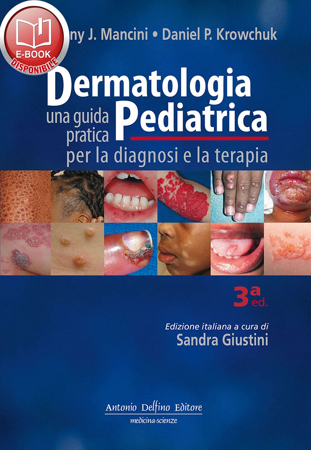 Dermatologia Pediatrica. Una Guida Pratica Per La Diagnosi E La Terapia - 4