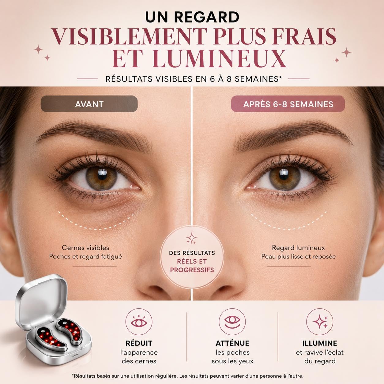Patchs LED Rechargeables pour le Contour des Yeux – Massage à Lumière Rouge Anti-Cernes, Anti-Poches et Anti-Rides, Soin Raffermissant Portable pour un Regard Plus Éclatant