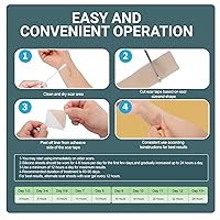 Vista 7 de Hojas de silicona para cicatrices para eliminación de cicatrices, cinta reutilizable para cicatrices quirúrgicas, cesáreas, queloides y quemaduras