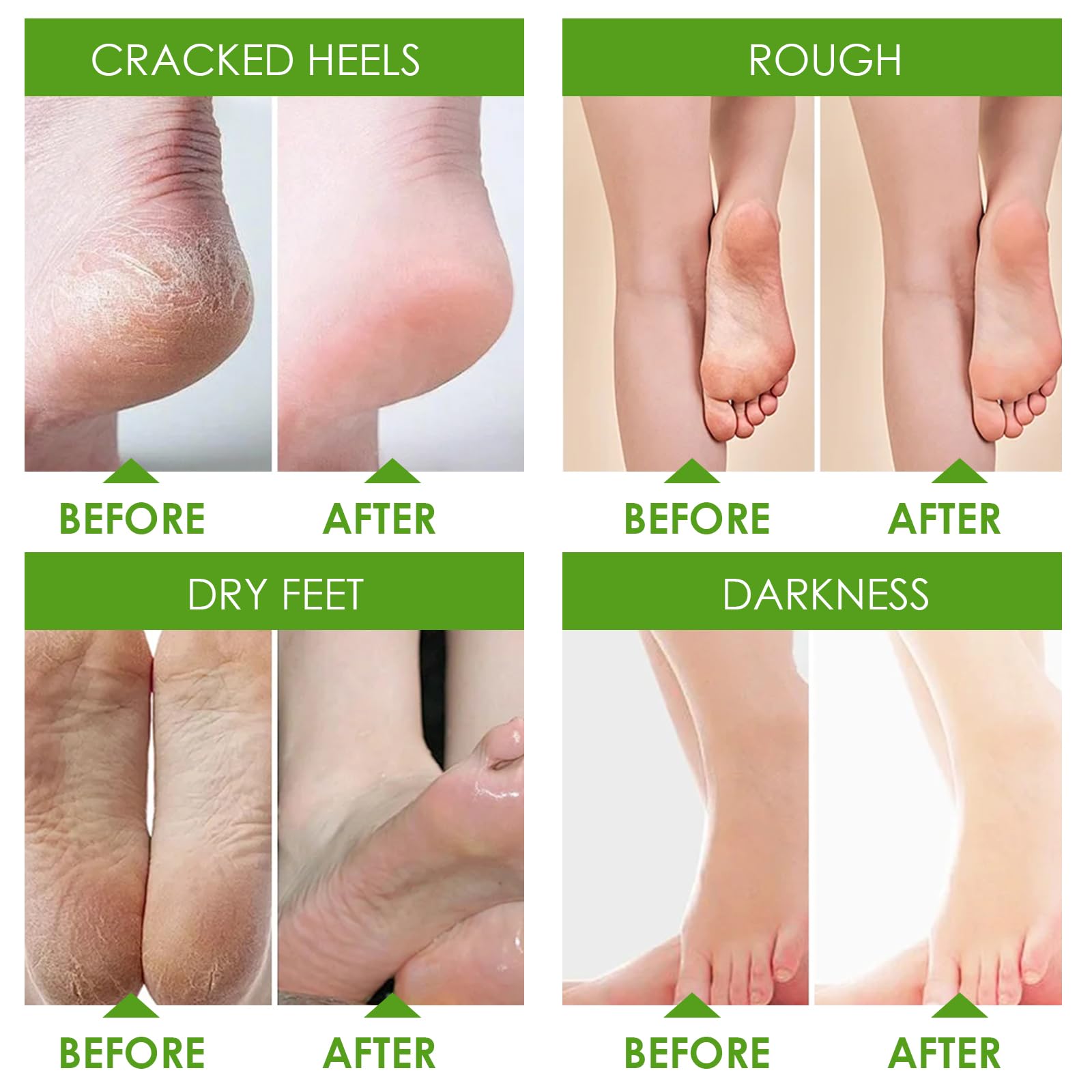 2 Paires Masque Pied, Masque Peeling Pieds et Nourrissant, Beauté pour Pied Secs et fendillés, Pieds Doux, Füße, Pour Femmes Hommes(Aloe Vera)