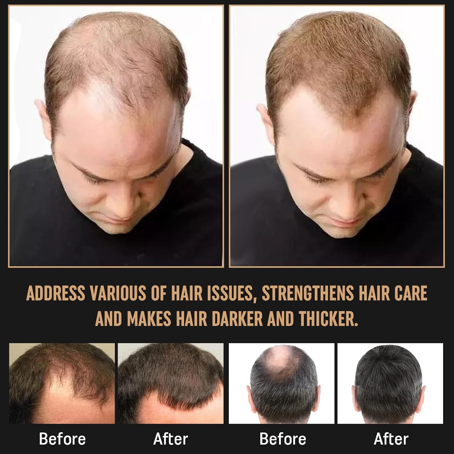 2Pcs Root Activator Shampoo - Hair Growth Root Activator Shampoo for Men and Women - Natural Formula for Hair Loss and Thinning Hair - Image 5