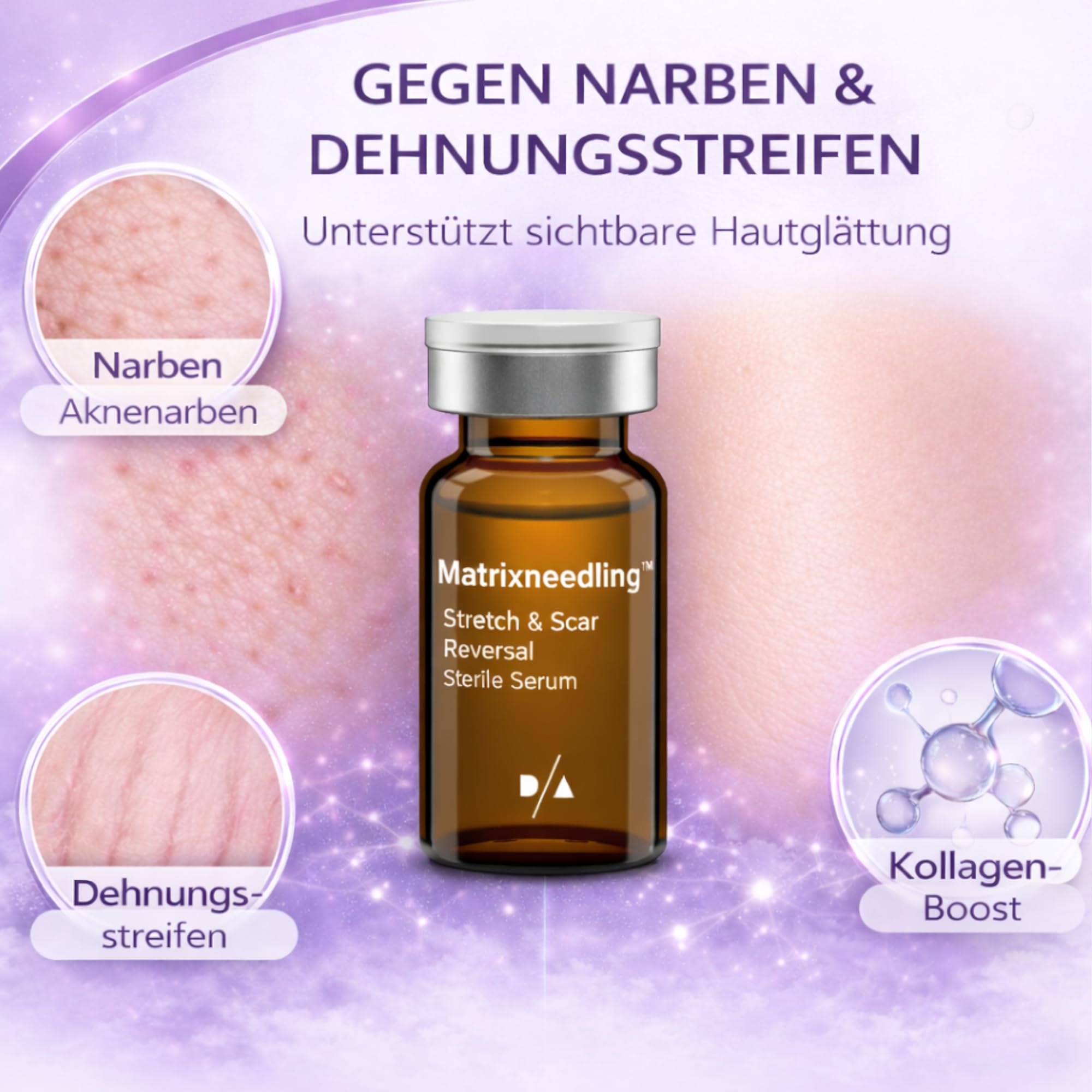 Matrixneedling™ Stretch & Scar Reversal – Microneedling Serum gegen Narben & Dehnungsstreifen – Aknenarben Serum & Kollagen Booster – Dermapen & Dermaroller Narbenbehandlung für glattere Hautstruktur