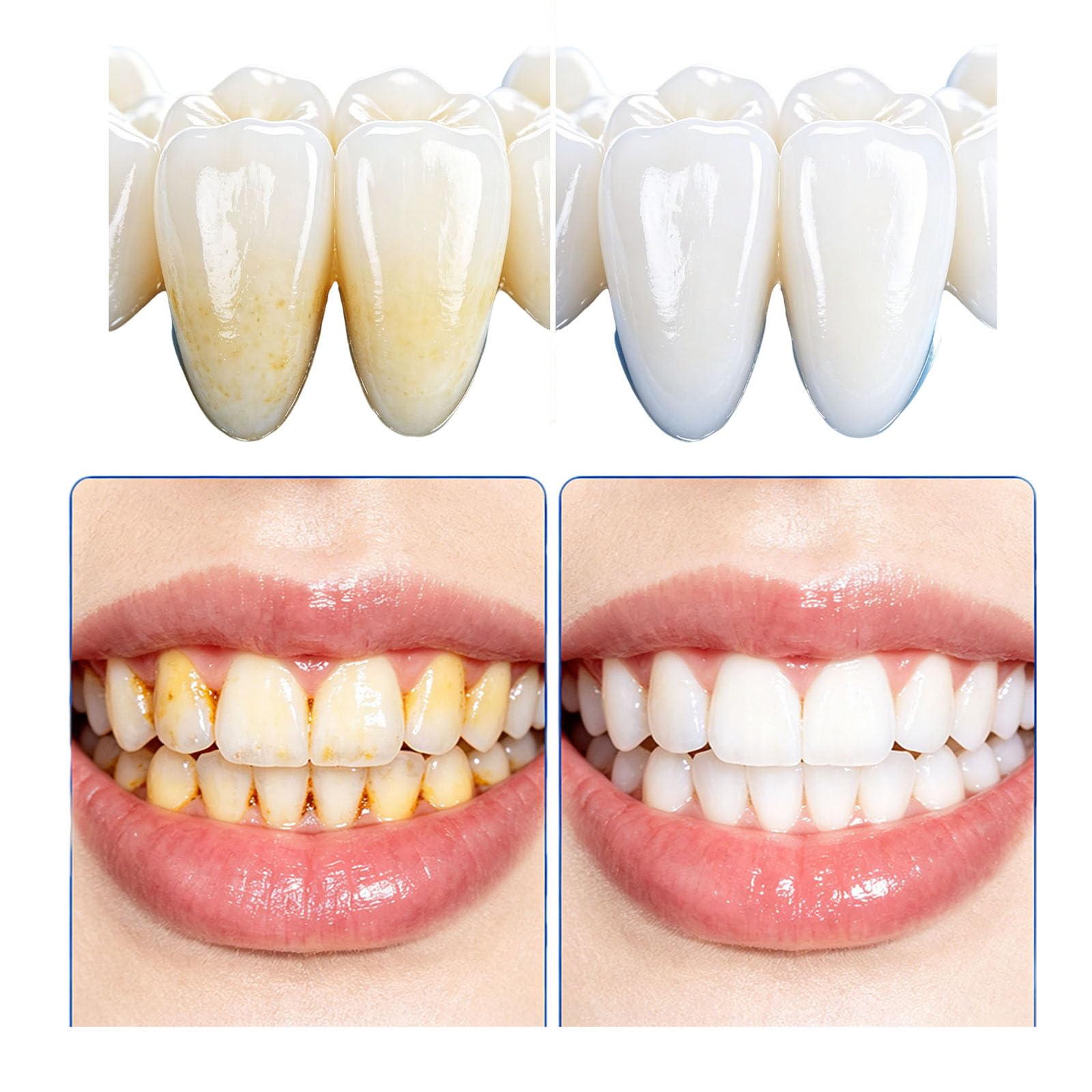 Sensitivity Relief & Whitening - Pasta de dientes libre de fluoruros, mentol, pasta de dientes blanqueadora intensiva, blanca/ning y eliminación de manchas, dientes remineralizantes de goma