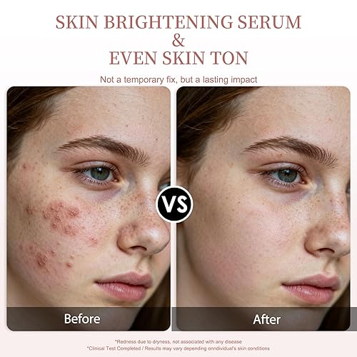 Miniatura 4 de Suero de vitamina C para la cara - Suero facial iluminador, antienvejecimiento y arrugas con vitamina C, hialuronato de sodio, vitamina E y más.