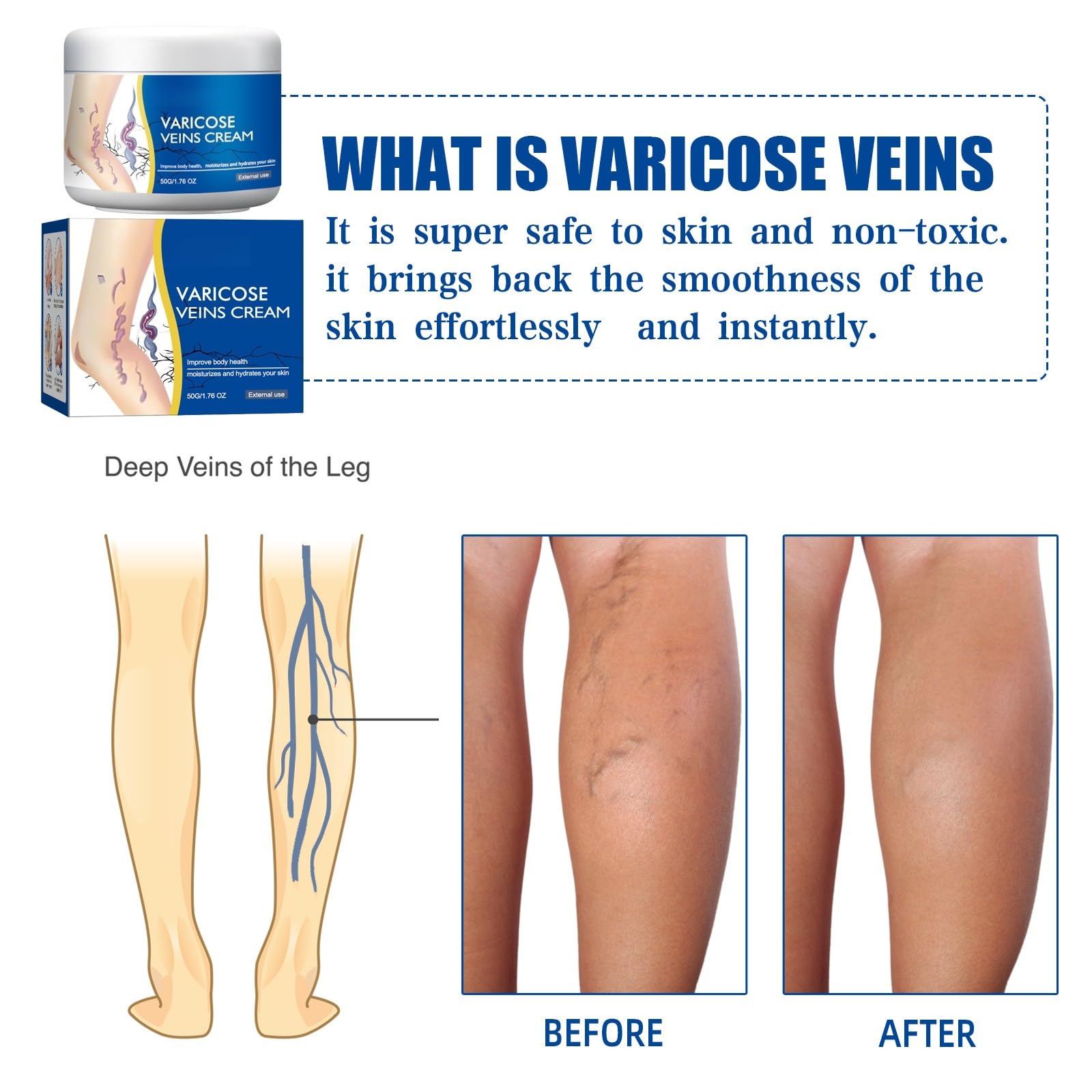 Crema per Vene Varicose,Crema per Vene Varicose Gambe,Cremas Lenitiva per Gambe,Cremas Trattamento Delle Venes Varicoses,50G