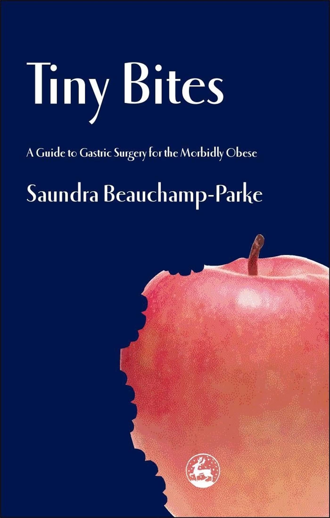 Buy Tiny Bites: A Guide to Gastric Surgery for the Morbidly Obese — BookShops.in
