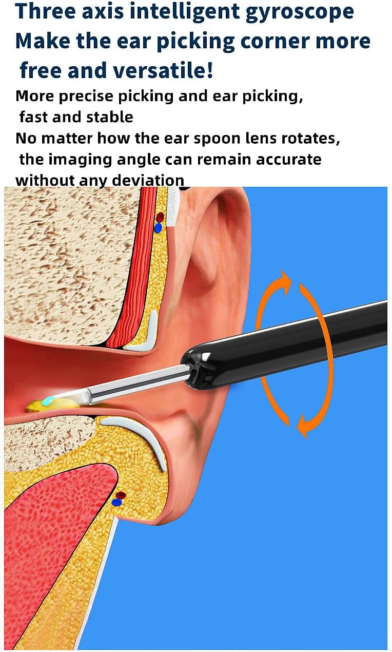 Illustration of the three-axis intelligent gyroscope maintaining a stable image while the ear sampling stick rotates.