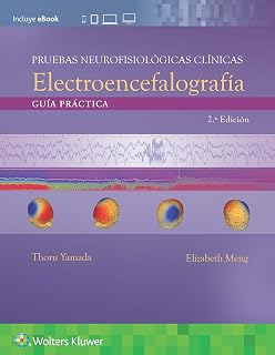 Electroencefalografia: Guia Practica