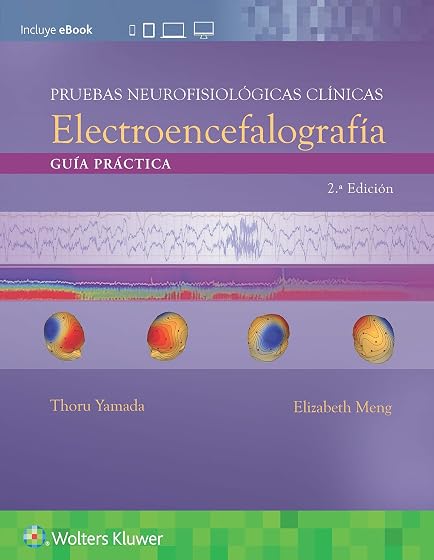 Electroencefalografia: Guia Practica