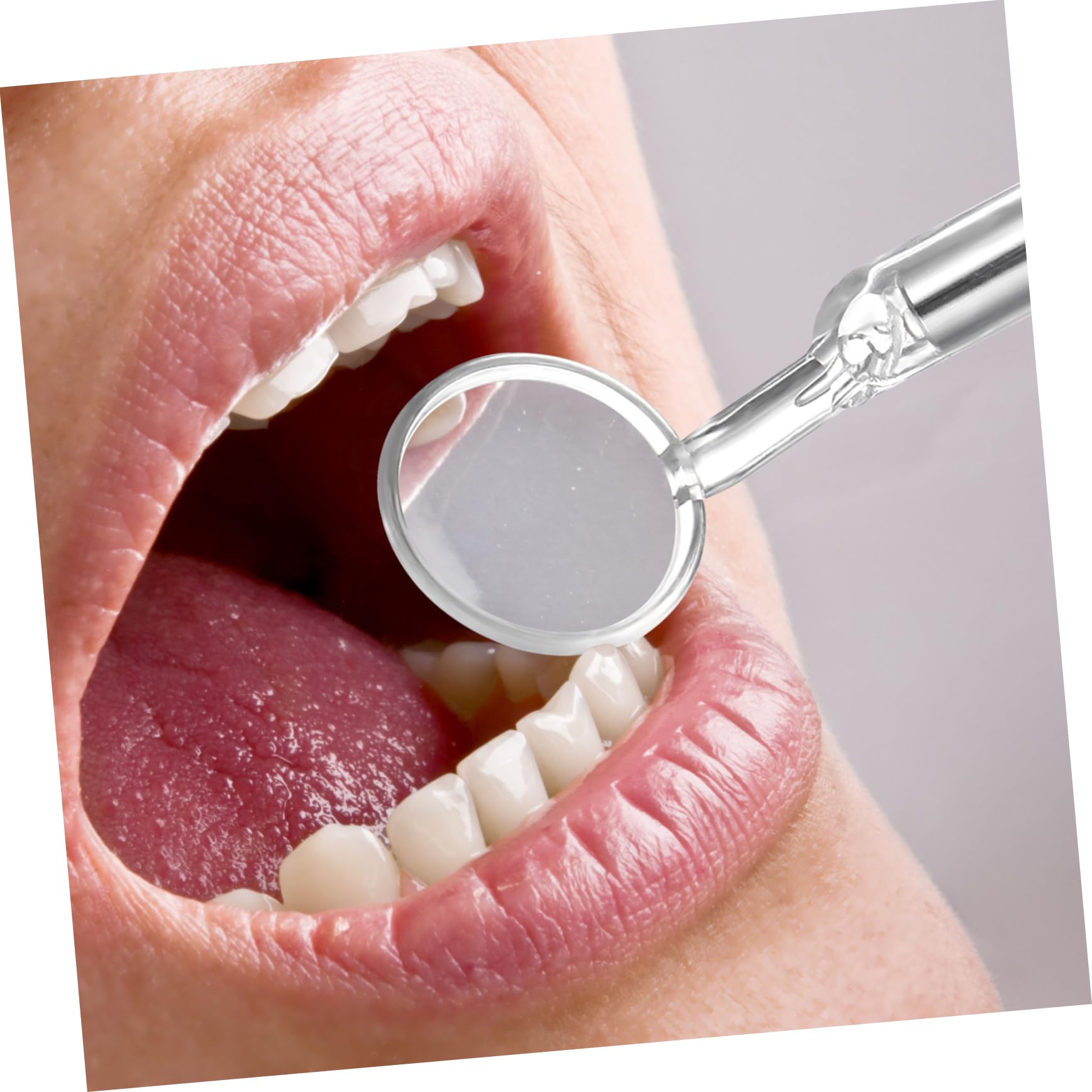 TOVINANNA Stainless Steel with Light for Oral Care Inspection Tool for Teeth Cleaning and Diagnosis Fog Design