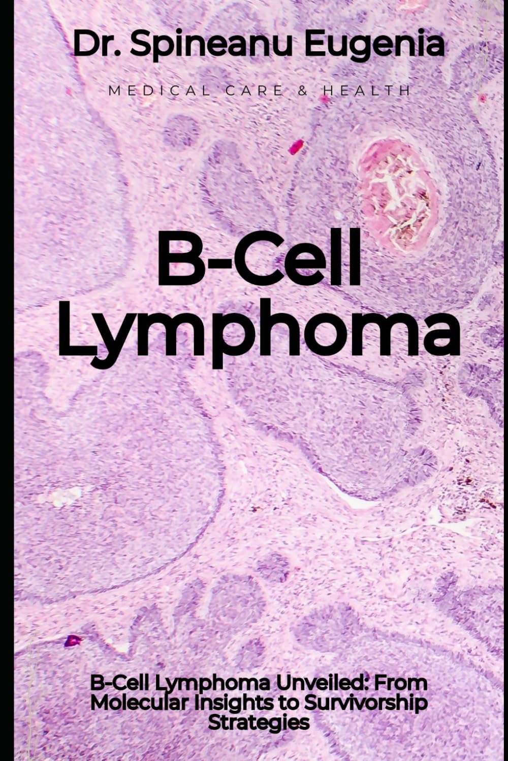 B-Cell Lymphoma (Medical care and health) Paperback – February 17, 2024
