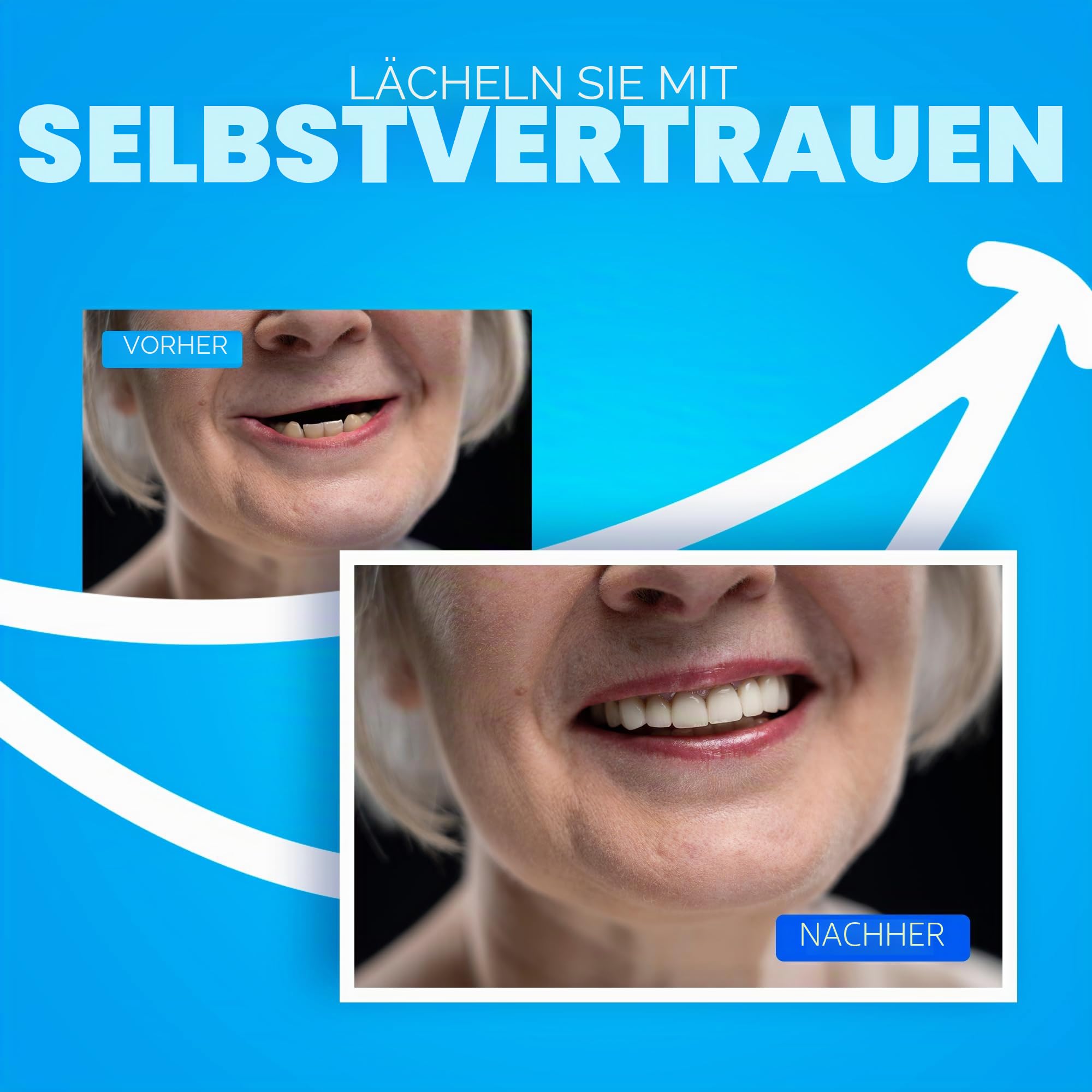 DIY Zahnersatz, anpassbares Kit mit 12 Teilen, einfach zu bedienen, Zahnersatz für Zuhause für ein ideales Lächeln